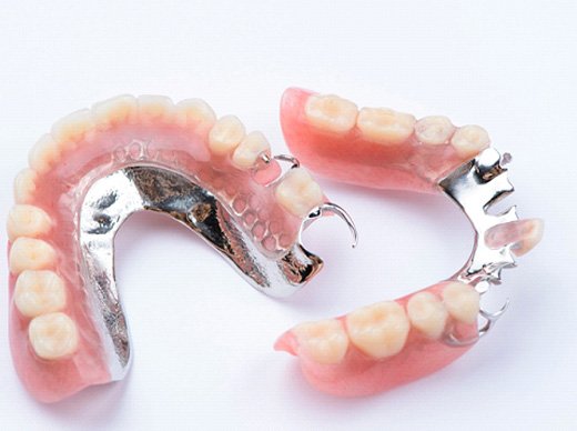 Set of partial dentures with metal on white background