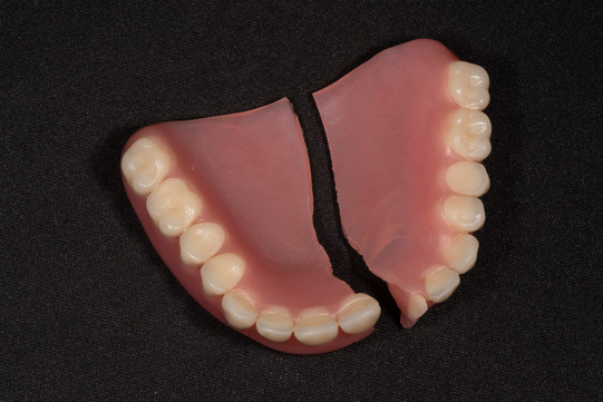 broken denture on table 